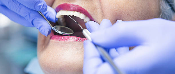 Best Emergency Tooth Extraction in Alderwood Manor, WA